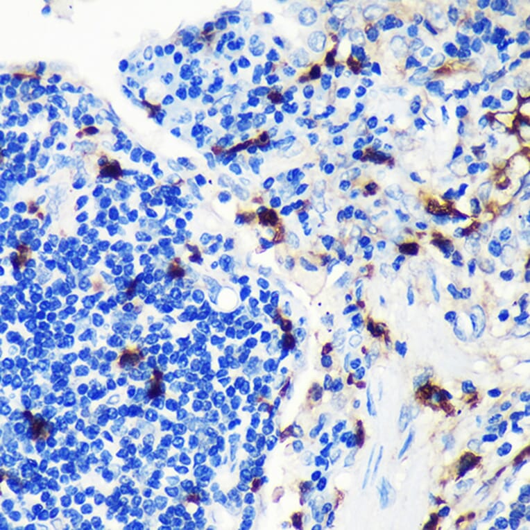 Immunohistochemistry - Anti-MRP8 Antibody [ARC0478] (A307526) - Antibodies.com