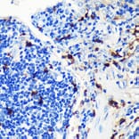 Immunohistochemistry - Anti-MRP8 Antibody [ARC0478] (A307526) - Antibodies.com
