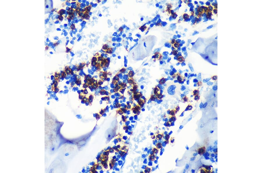 Immunohistochemistry - Anti-MRP8 Antibody [ARC0478] (A307526) - Antibodies.com