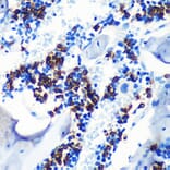 Immunohistochemistry - Anti-MRP8 Antibody [ARC0478] (A307526) - Antibodies.com
