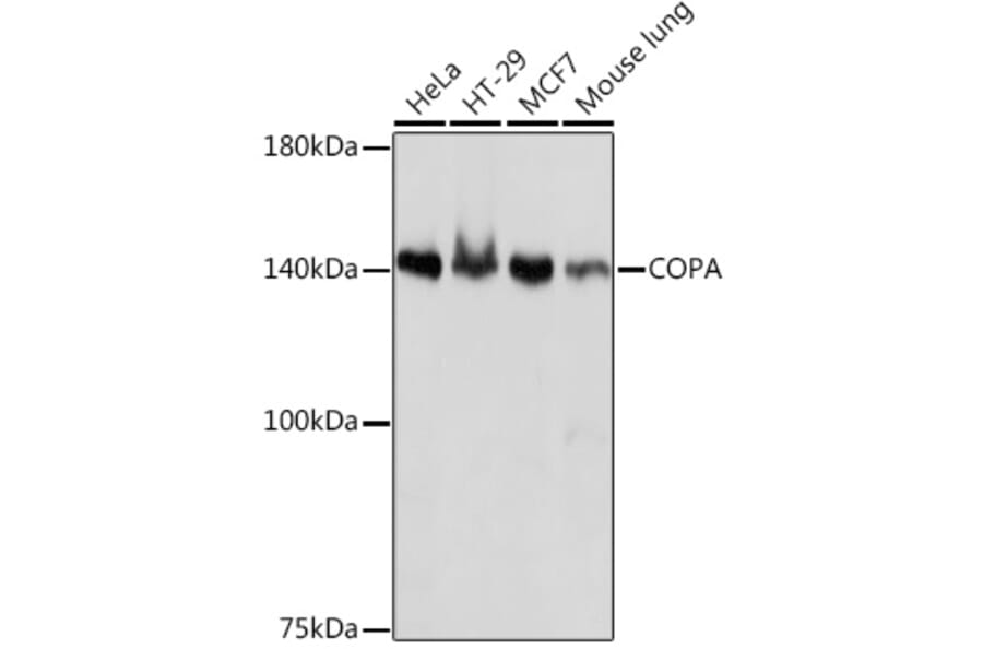 Western Blot - Anti-alpha COP I/COPA Antibody [ARC2215] (A307527) - Antibodies.com