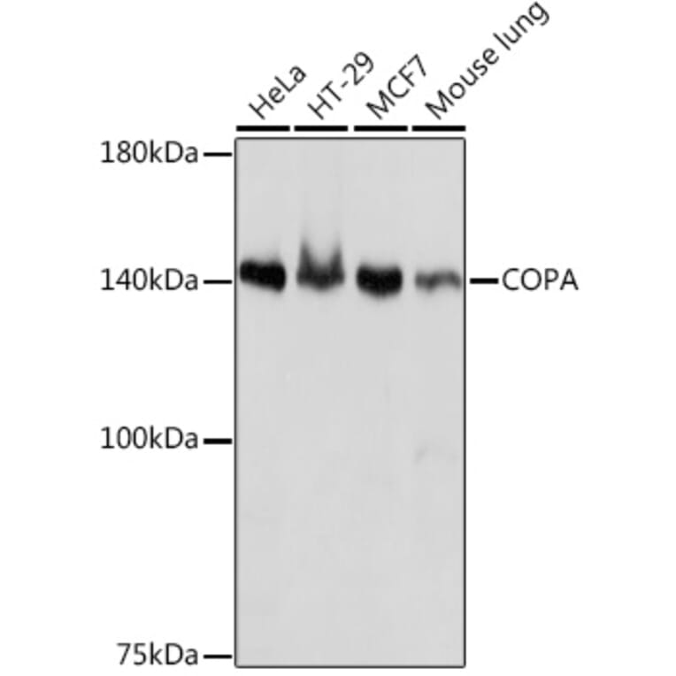 Western Blot - Anti-alpha COP I/COPA Antibody [ARC2215] (A307527) - Antibodies.com