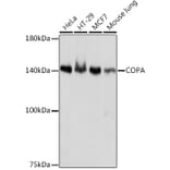 Western Blot - Anti-alpha COP I/COPA Antibody [ARC2215] (A307527) - Antibodies.com