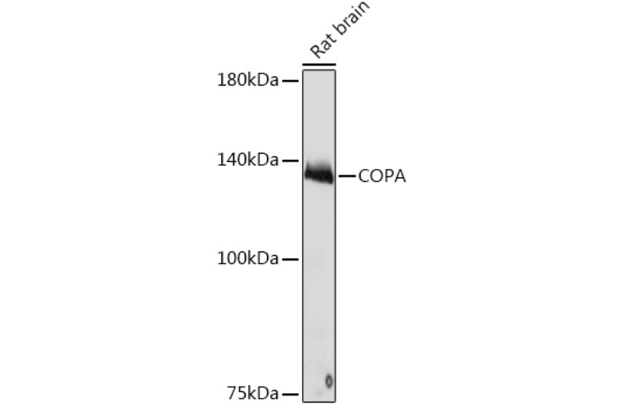 Western Blot - Anti-alpha COP I/COPA Antibody [ARC2215] (A307527) - Antibodies.com