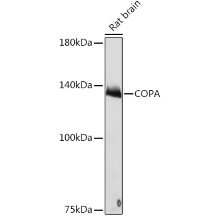 Western Blot - Anti-alpha COP I/COPA Antibody [ARC2215] (A307527) - Antibodies.com