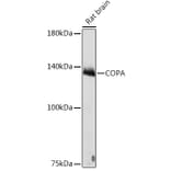 Western Blot - Anti-alpha COP I/COPA Antibody [ARC2215] (A307527) - Antibodies.com