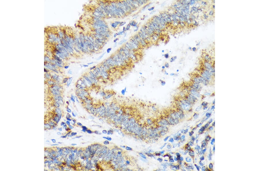 Immunohistochemistry - Anti-alpha COP I/COPA Antibody [ARC2215] (A307527) - Antibodies.com