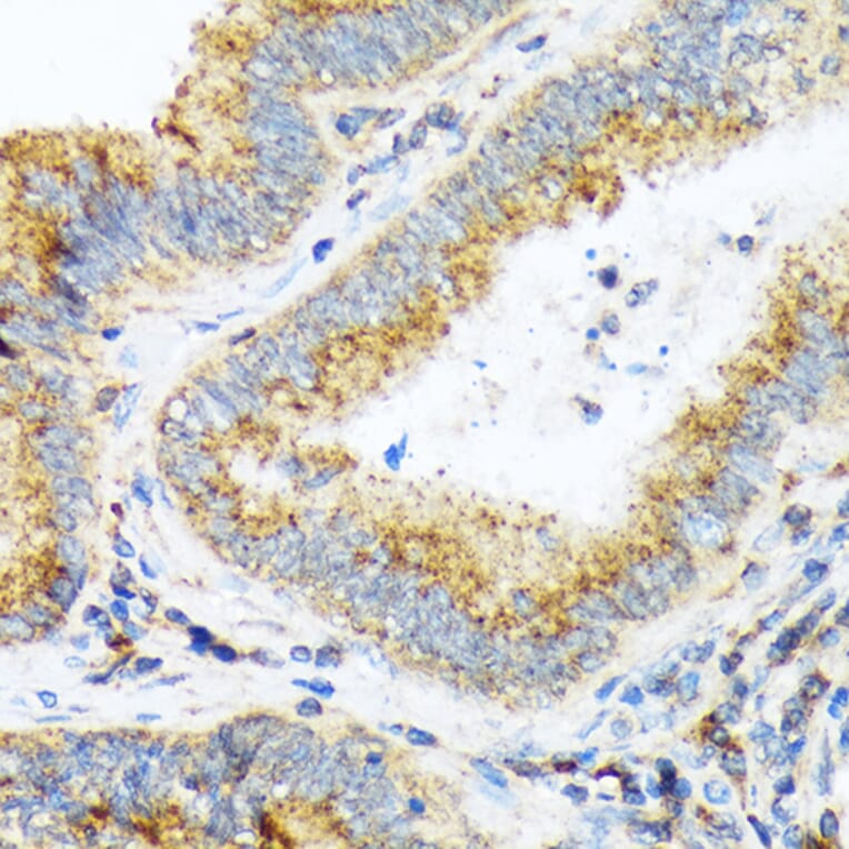 Immunohistochemistry - Anti-alpha COP I/COPA Antibody [ARC2215] (A307527) - Antibodies.com
