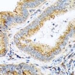Immunohistochemistry - Anti-alpha COP I/COPA Antibody [ARC2215] (A307527) - Antibodies.com