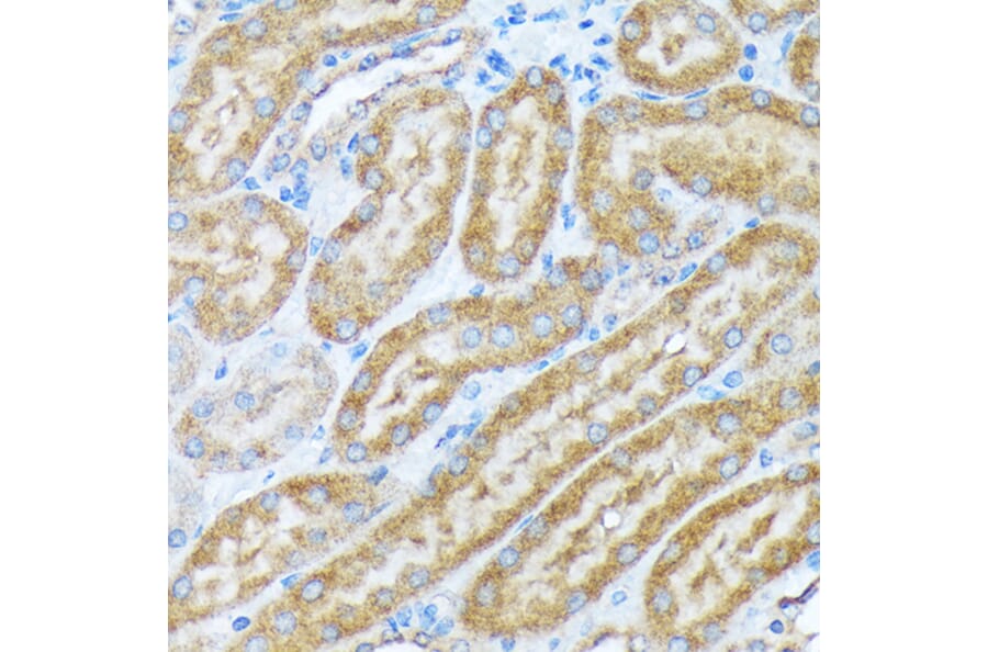 Immunohistochemistry - Anti-alpha COP I/COPA Antibody [ARC2215] (A307527) - Antibodies.com
