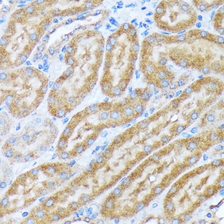 Immunohistochemistry - Anti-alpha COP I/COPA Antibody [ARC2215] (A307527) - Antibodies.com