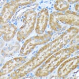 Immunohistochemistry - Anti-alpha COP I/COPA Antibody [ARC2215] (A307527) - Antibodies.com