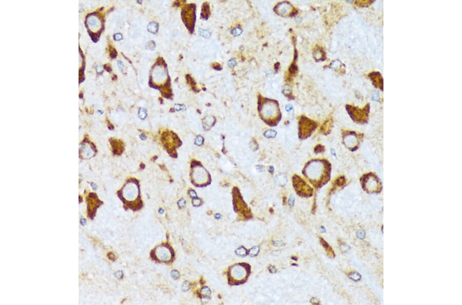 Immunohistochemistry - Anti-alpha COP I/COPA Antibody [ARC2215] (A307527) - Antibodies.com