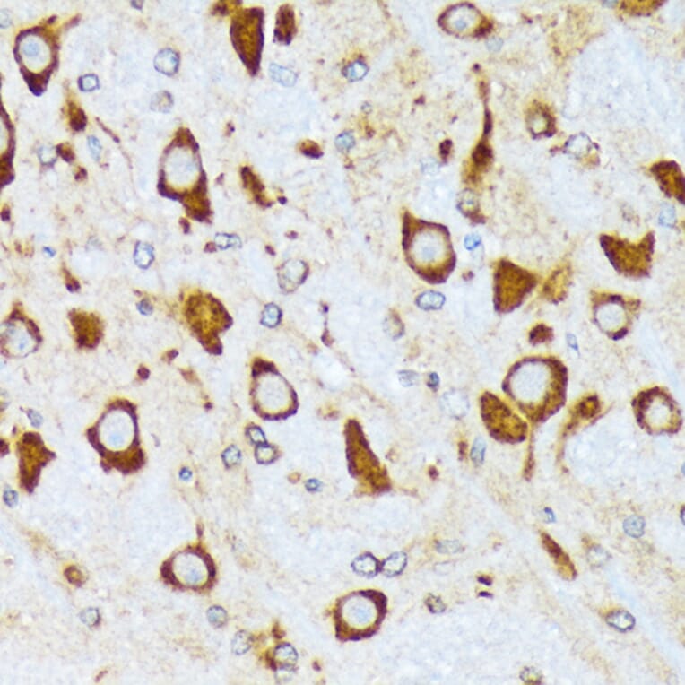 Immunohistochemistry - Anti-alpha COP I/COPA Antibody [ARC2215] (A307527) - Antibodies.com