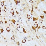Immunohistochemistry - Anti-alpha COP I/COPA Antibody [ARC2215] (A307527) - Antibodies.com