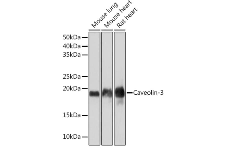 Western Blot - Anti-Caveolin-3 Antibody [ARC2473] (A307529) - Antibodies.com