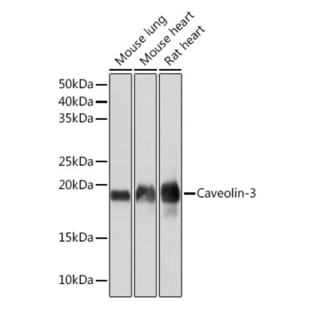 Western Blot - Anti-Caveolin-3 Antibody [ARC2473] (A307529) - Antibodies.com