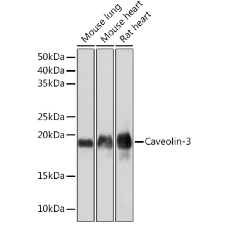 Western Blot - Anti-Caveolin-3 Antibody [ARC2473] (A307529) - Antibodies.com