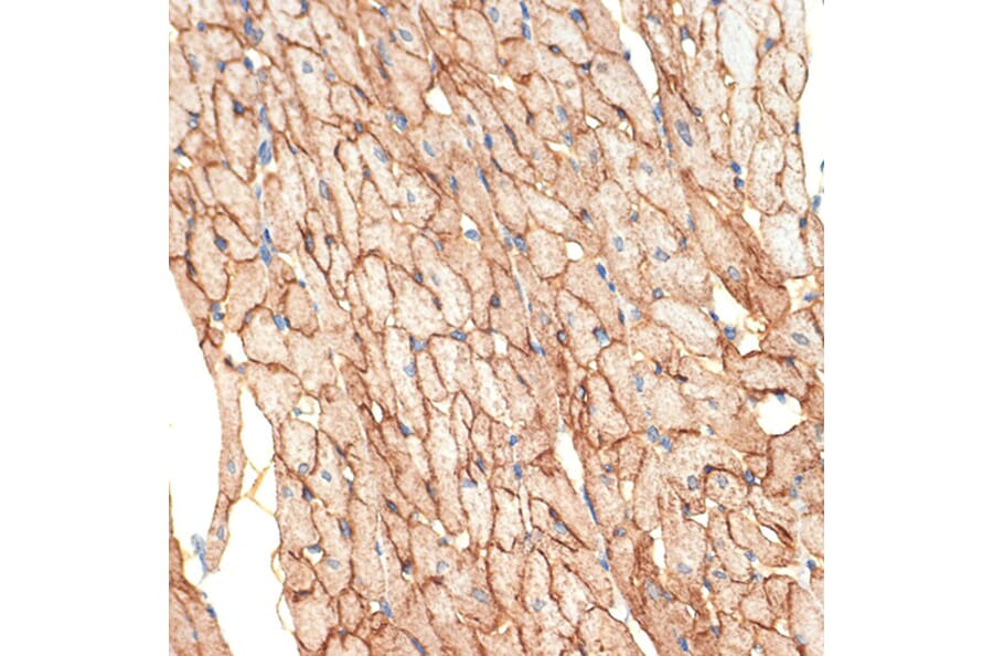 Immunohistochemistry - Anti-Caveolin-3 Antibody [ARC2473] (A307529) - Antibodies.com
