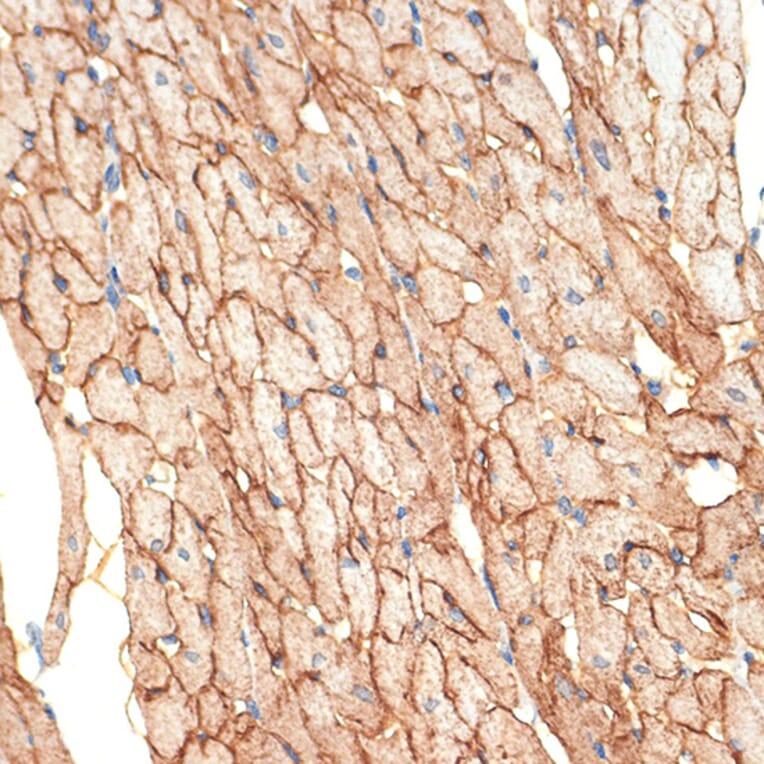 Immunohistochemistry - Anti-Caveolin-3 Antibody [ARC2473] (A307529) - Antibodies.com