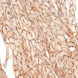 Immunohistochemistry - Anti-Caveolin-3 Antibody [ARC2473] (A307529) - Antibodies.com