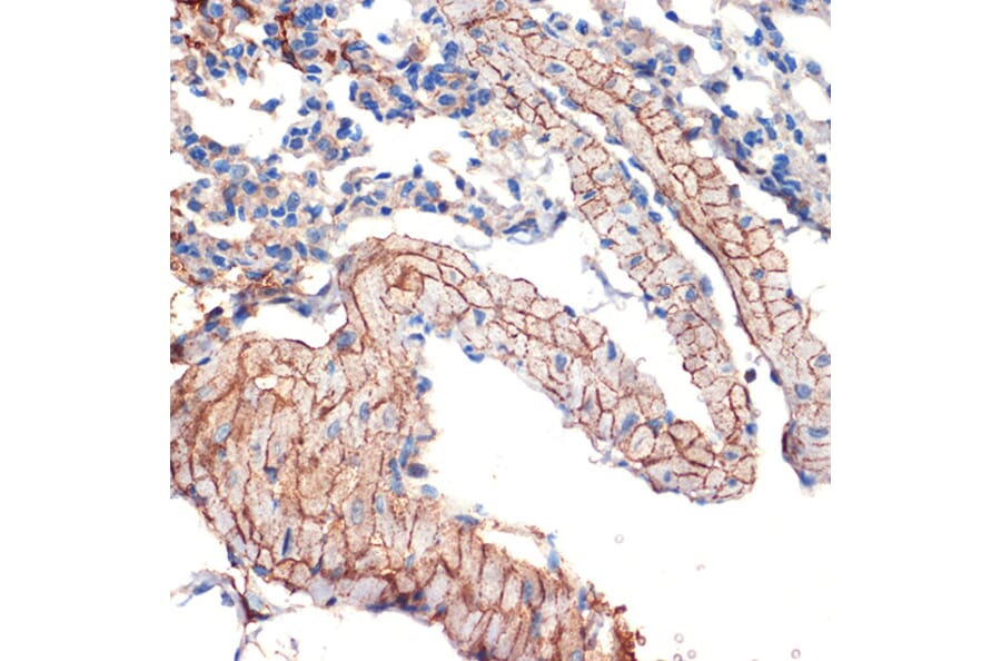 Immunohistochemistry - Anti-Caveolin-3 Antibody [ARC2473] (A307529) - Antibodies.com