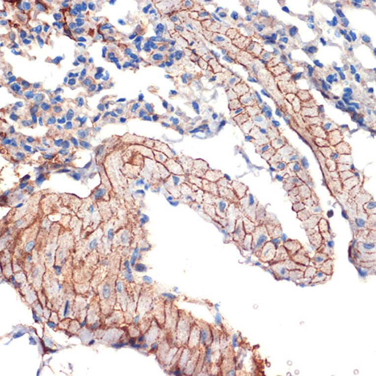 Immunohistochemistry - Anti-Caveolin-3 Antibody [ARC2473] (A307529) - Antibodies.com