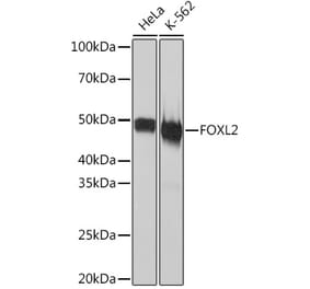 Western Blot - Anti-FOXL2 Antibody [ARC2055] (A307530) - Antibodies.com