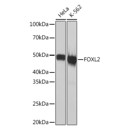 Western Blot - Anti-FOXL2 Antibody [ARC2055] (A307530) - Antibodies.com