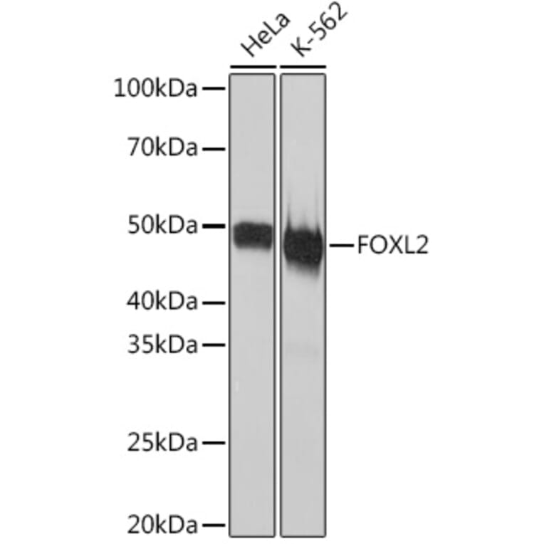 Western Blot - Anti-FOXL2 Antibody [ARC2055] (A307530) - Antibodies.com