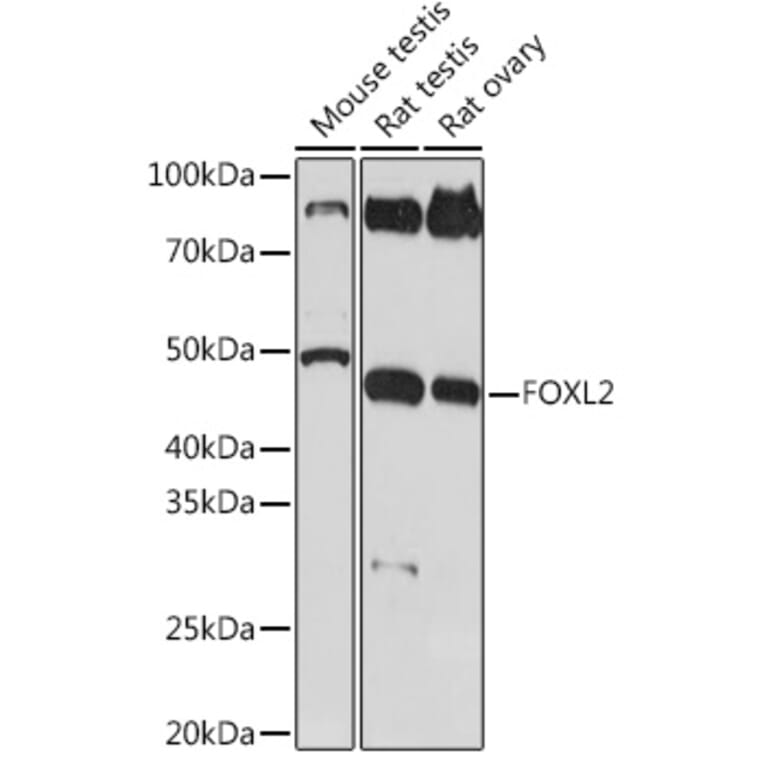 Western Blot - Anti-FOXL2 Antibody [ARC2055] (A307530) - Antibodies.com