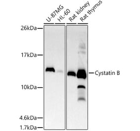 Western Blot - Anti-Cystatin-B Antibody [ARC2833] (A307531) - Antibodies.com