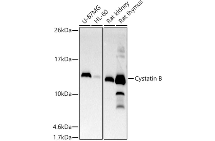 Western Blot - Anti-Cystatin-B Antibody [ARC2833] (A307531) - Antibodies.com