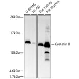 Western Blot - Anti-Cystatin-B Antibody [ARC2833] (A307531) - Antibodies.com