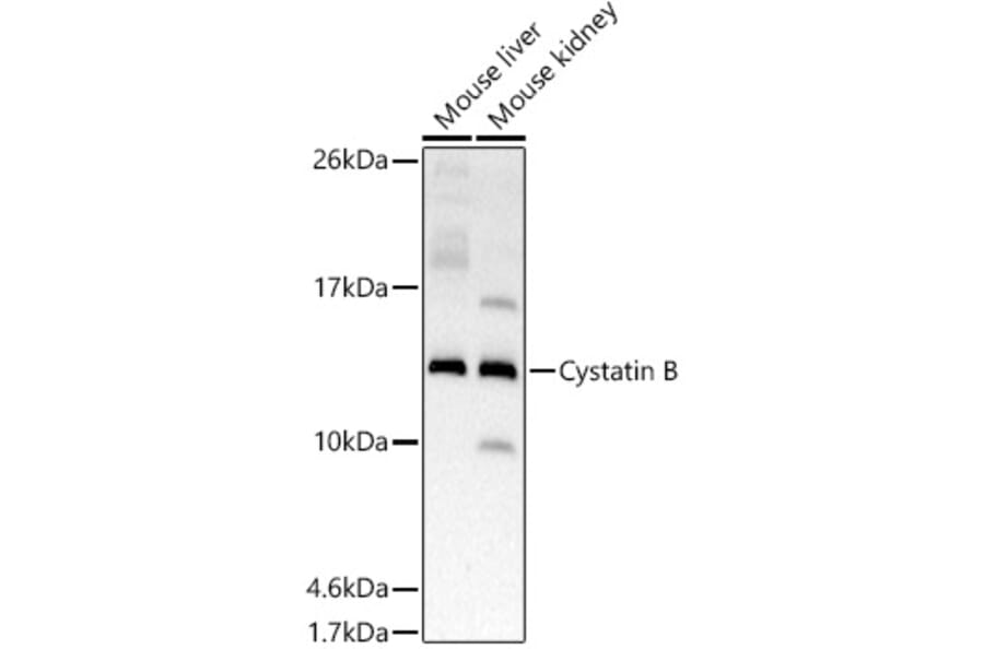 Western Blot - Anti-Cystatin-B Antibody [ARC2833] (A307531) - Antibodies.com
