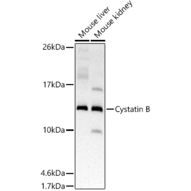 Western Blot - Anti-Cystatin-B Antibody [ARC2833] (A307531) - Antibodies.com