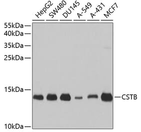 Western Blot - Anti-Cystatin-B Antibody (A307532) - Antibodies.com