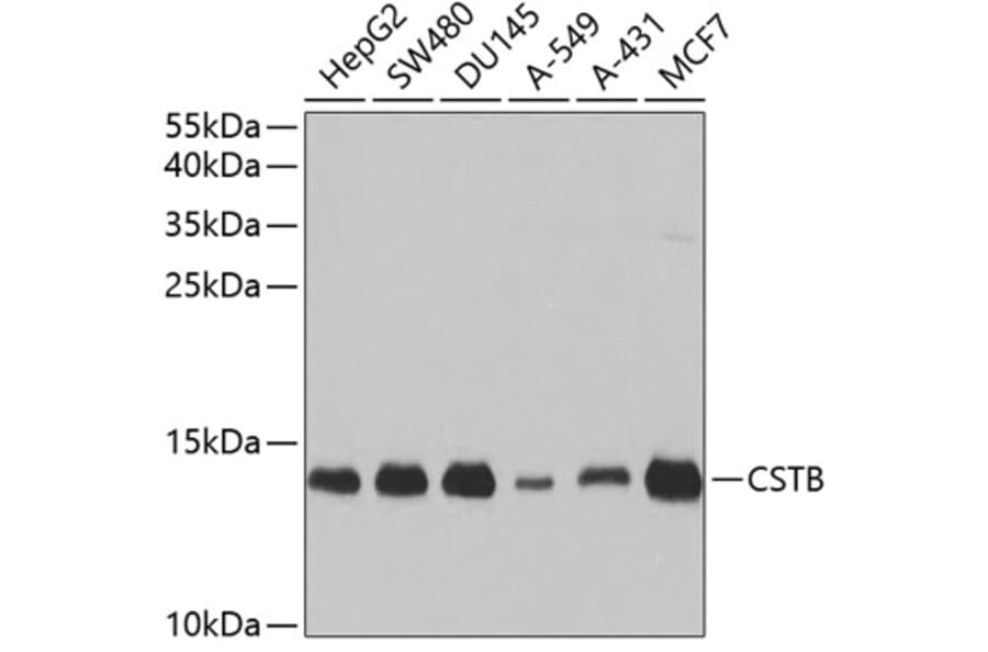 Western Blot - Anti-Cystatin-B Antibody (A307532) - Antibodies.com