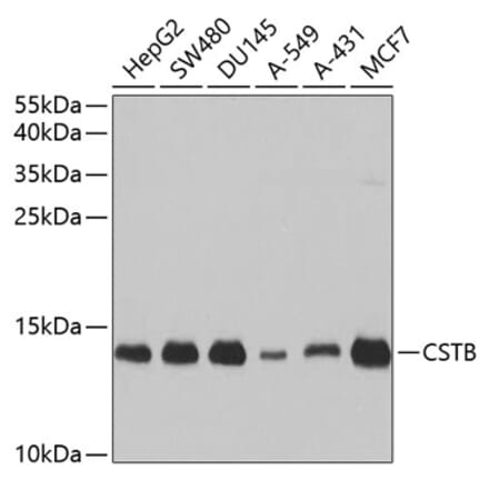 Western Blot - Anti-Cystatin-B Antibody (A307532) - Antibodies.com