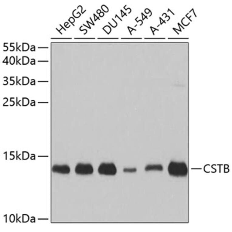 Western Blot - Anti-Cystatin-B Antibody (A307532) - Antibodies.com