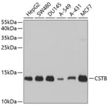 Western Blot - Anti-Cystatin-B Antibody (A307532) - Antibodies.com