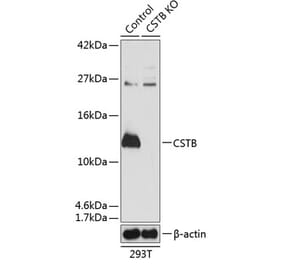 Western Blot - Anti-Cystatin-B Antibody (A307533) - Antibodies.com