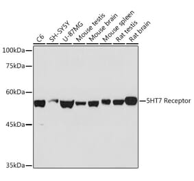 Western Blot - Anti-5HT7 Receptor Antibody [ARC2238] (A307535) - Antibodies.com