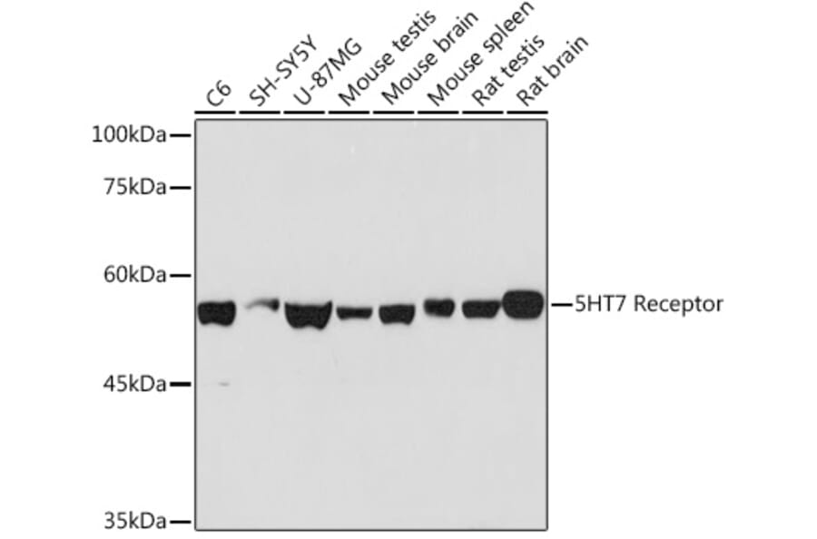 Western Blot - Anti-5HT7 Receptor Antibody [ARC2238] (A307535) - Antibodies.com