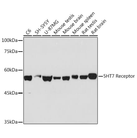 Western Blot - Anti-5HT7 Receptor Antibody [ARC2238] (A307535) - Antibodies.com