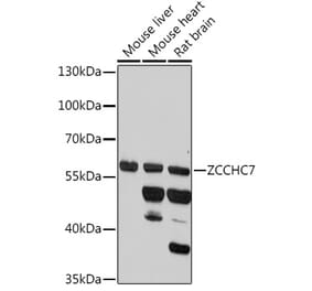 Western Blot - Anti-ZCCHC7 Antibody (A307536) - Antibodies.com