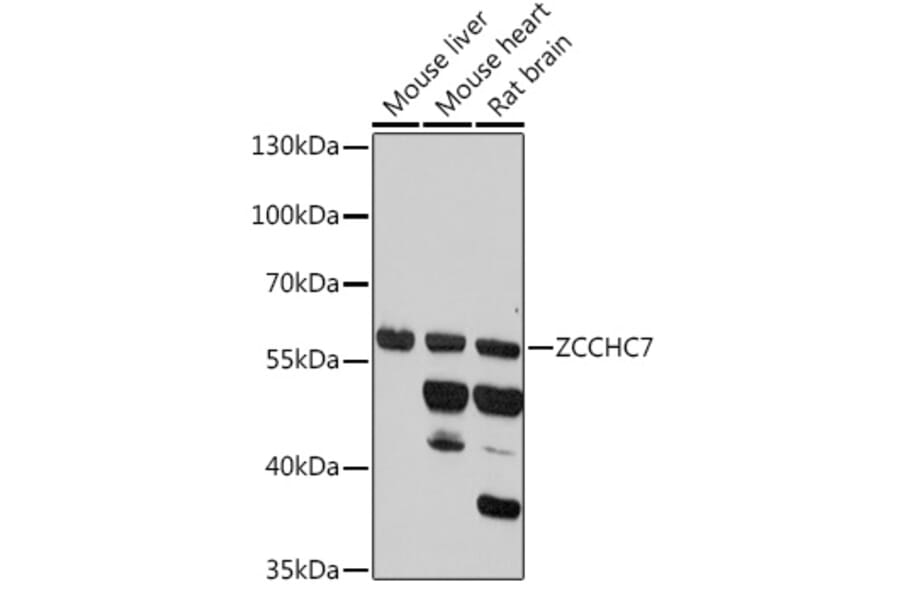 Western Blot - Anti-ZCCHC7 Antibody (A307536) - Antibodies.com
