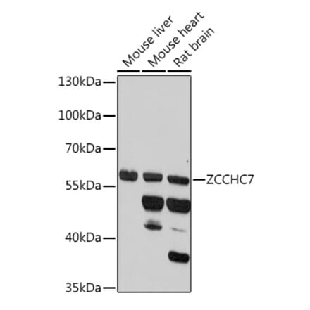 Western Blot - Anti-ZCCHC7 Antibody (A307536) - Antibodies.com
