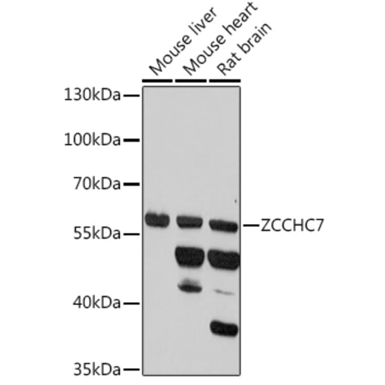 Western Blot - Anti-ZCCHC7 Antibody (A307536) - Antibodies.com