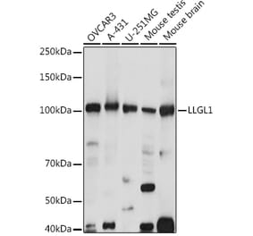 Western Blot - Anti-LLGL1 Antibody (A307538) - Antibodies.com